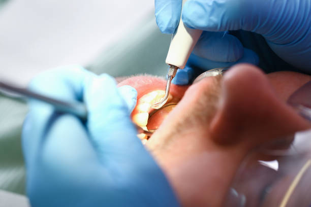 Best Same-Day Emergency Dental Services in Winterville, NC