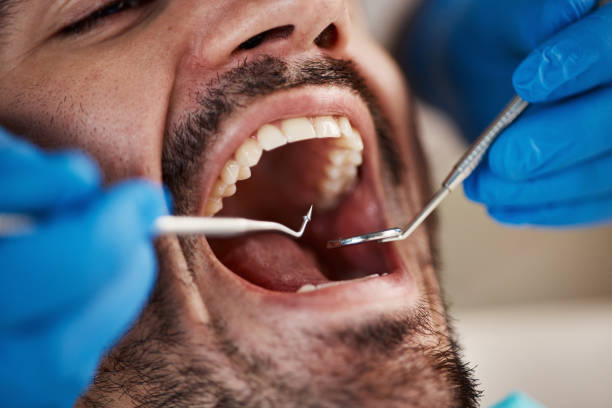Best Emergency Treatment for Dental Infections or Abscesses in Winterville, NC